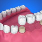 Emergency Dental Care: Navigating Oral Surgery with Expertise and Care