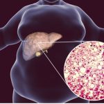 How Neurologists Diagnose Brain Disorders