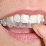 6 Facts You Should Know About Gum Disease