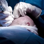 Obstetricians And Gynecologists: The Key Players In Reducing Maternal Mortality