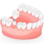 How to Choose the Right Cosmetic Dentist