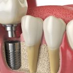 The Importance of Regular Dental Check-Ups for Your Family