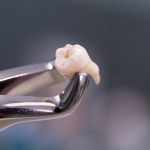 PRP for Hair Loss: Can You Start the Process with a Home Blood Test?