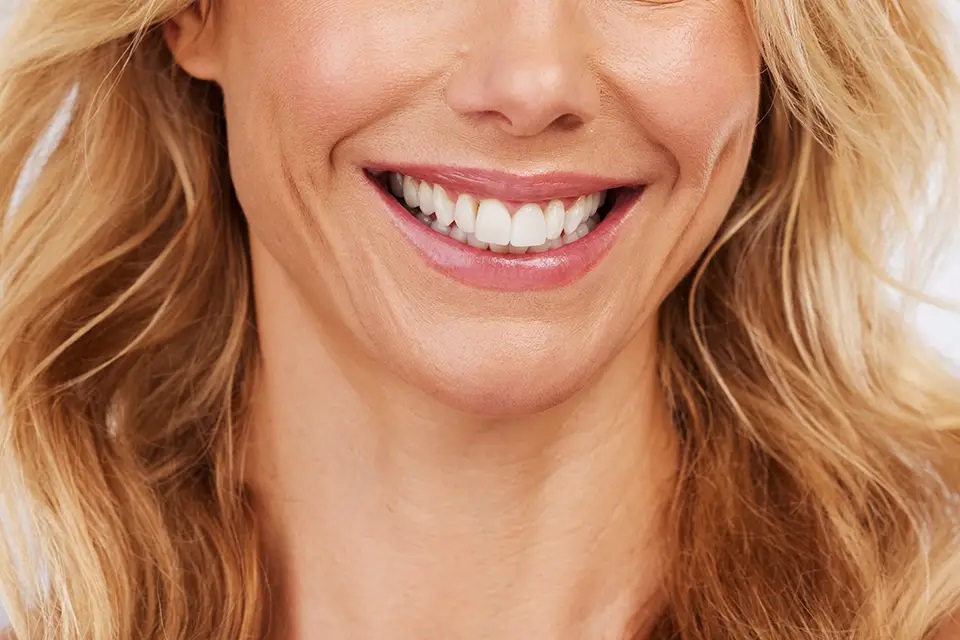 Best Veneers for Your Face Shape