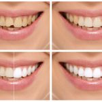 Decoding Your Diaper: How the “Baby Poop Chart” Can Inform Your Use of “Johnson’s Baby” Products