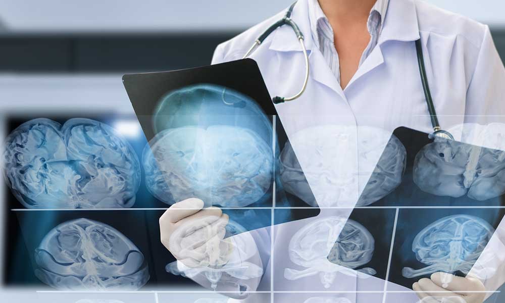 Amen Clinics: What You Need to Know About Brain Health Treatments