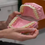 How Much Are Full Dental Implants? A Realistic Cost Breakdown